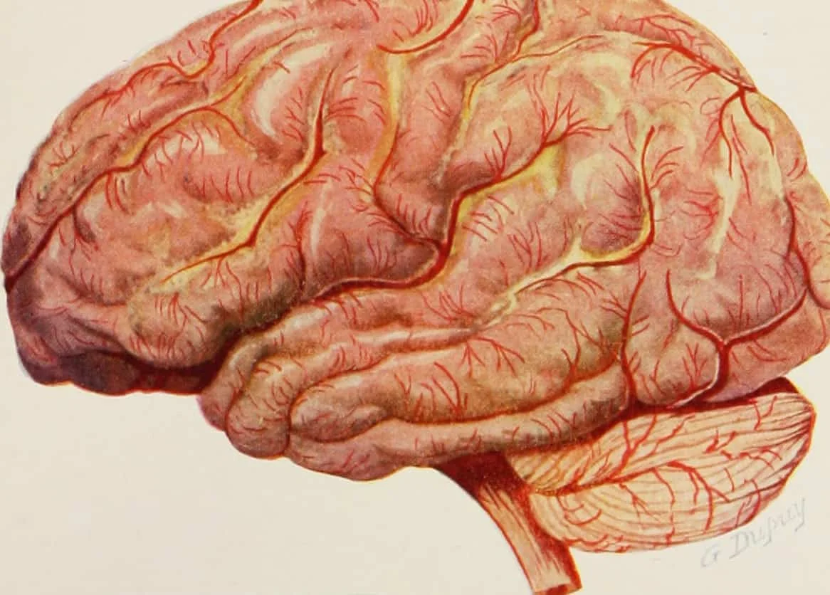 Brain - Image 1 | Dowson Turco Lawyers